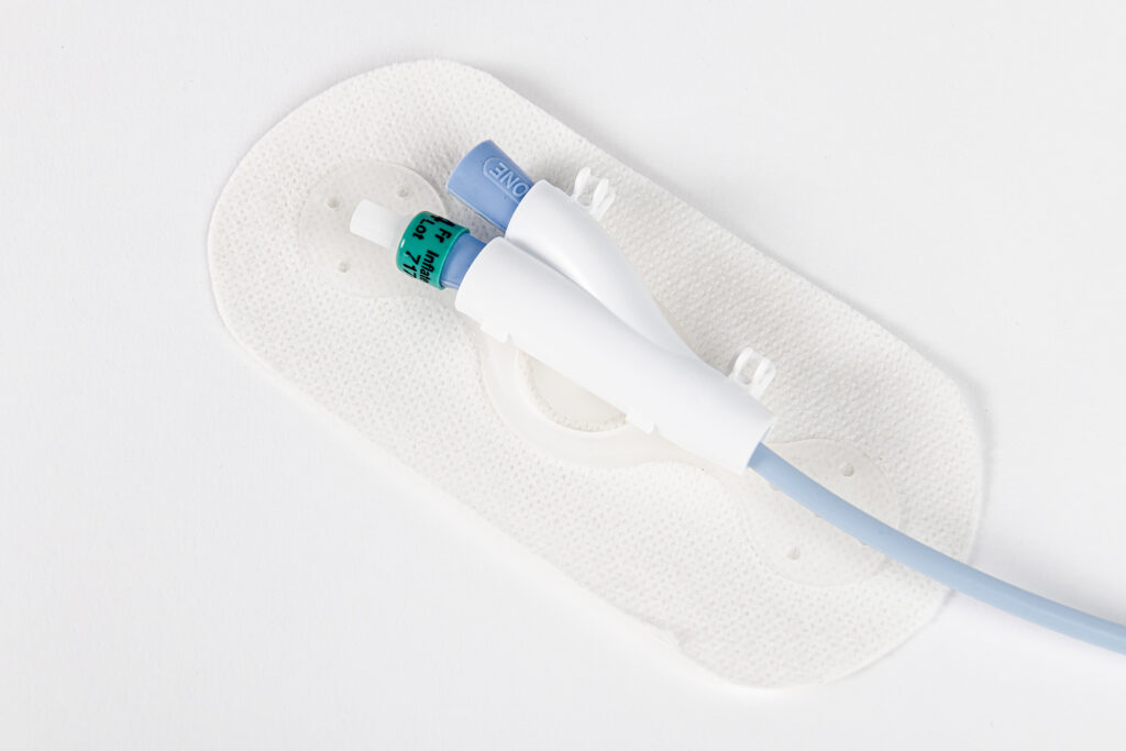 lecs 2 catheter stabilization device