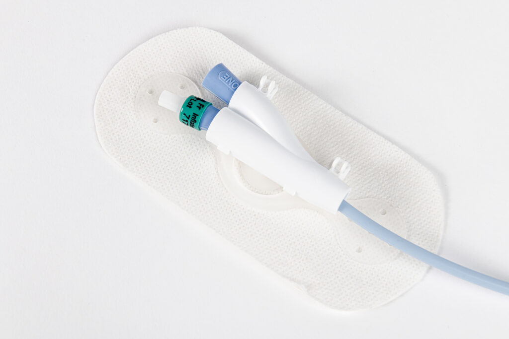 Suprapubic Catheter Stabilization Device | LECS I by Levity